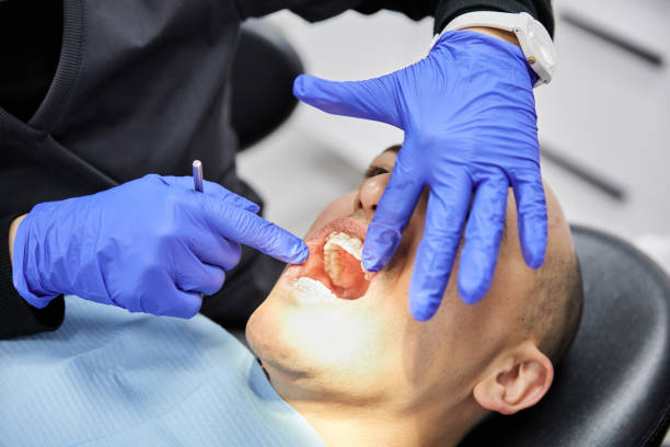 Best Emergency Dentist for Lost Fillings or Crowns in Alta Sierra, CA